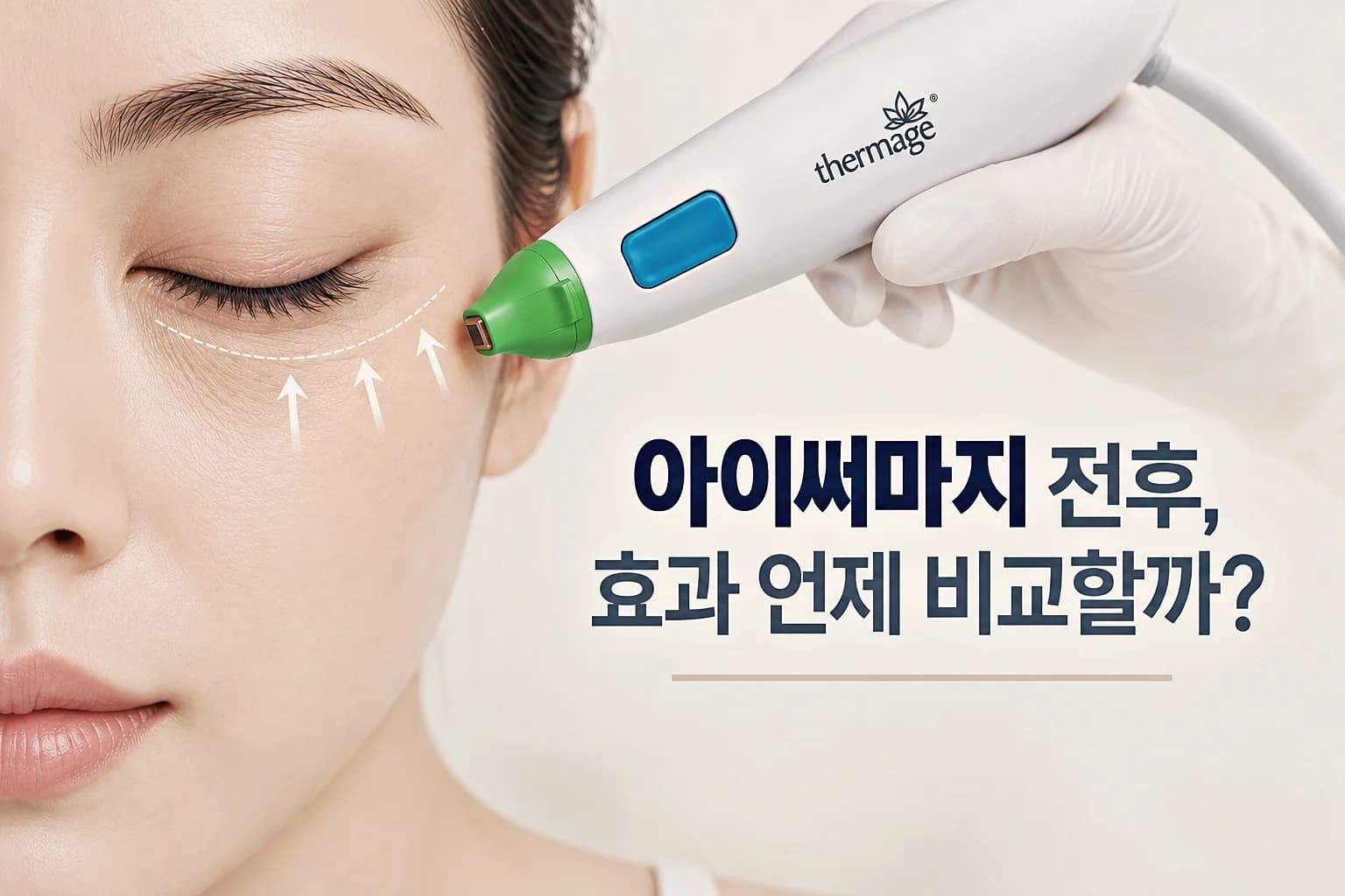 아이써마지 전후 확인 - 시점별 변화 흐름